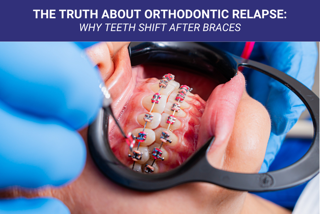 The Truth About Orthodontic Relapse: Why Teeth Shift After Braces